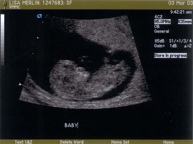 Sonogram 3