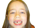 Maddy Tooth