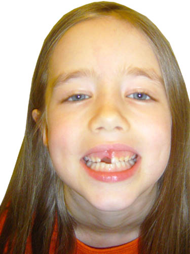 Tooth Maddy 01