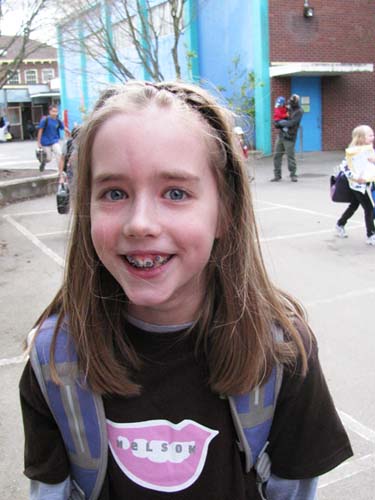 Maddy Braces