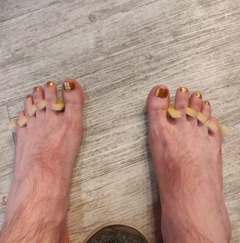Brock Feet